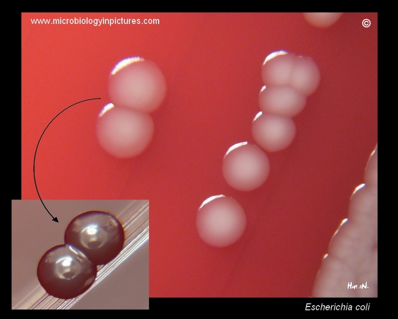 E.coli colonies